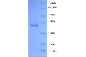 SDS-PAGE (SDS) image for Epidermal Growth Factor (EGF) (AA 977-1023) protein (GST tag) (ABIN1047548)