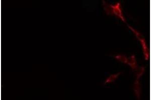 ABIN6276706 staining  Hela cells by IF/ICC.