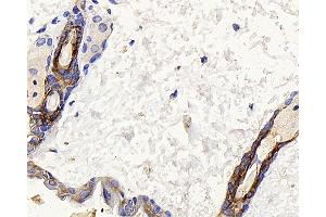 Immunohistochemistry analysis of paraffin-embedded mouse skin using CK-17 Polyclonal Antibody at dilution of 1:400.