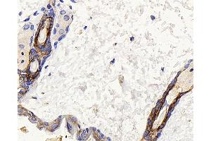 Immunohistochemistry analysis of paraffin-embedded mouse skin using CK-17 Polyclonal Antibody at dilution of 1:400. (KRT17 anticorps)