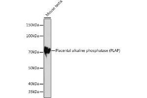 Western blot analysis of extracts of Mouse testis, using Placental alkaline phosphatase (PLAP) Rabbit mAb (ABIN1682693, ABIN7101664, ABIN7101665 and ABIN7101666) at 1:1000 dilution. (PLAP anticorps)