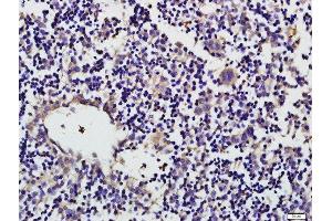 Paraformaldehyde-fixed, paraffin embedded mouse fetal liver tissue, Antigen retrieval by boiling in sodium citrate buffer(pH6) for 15min, Block endogenous peroxidase by 3% hydrogen peroxide for 30 minutes, Blocking buffer (normal goat serum) at 37°C for 20min, Antibody incubation with CD19 (Tyr531) Polyclonal Antibody, Unconjugated  at 1:500 overnight at 4°C, followed by a conjugated secondary and DAB staining