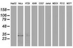 Image no. 2 for anti-Eukaryotic Translation Initiation Factor 4E Family Member 2 (EIF4E2) antibody (ABIN1497993) (EIF4E2 anticorps)
