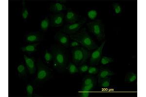 Immunofluorescence of monoclonal antibody to HIPK1 on HeLa cell. (HIPK1 anticorps  (AA 330-430))