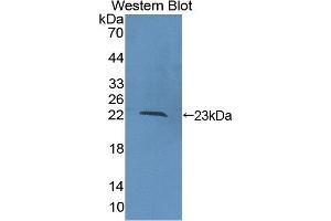 Detection of Recombinant COL16, Human using Polyclonal Antibody to Collagen Type XVI (COL16) (COL16 anticorps  (AA 1434-1604))