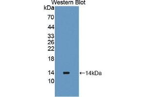 Western blot analysis of the recombinant protein. (PLOD2 anticorps  (AA 644-737))