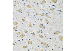 Immunohistochemistry of paraffin-embedded mouse brain using FASTKD1 Antibody (ABIN5975129) at dilution of 1/100 (40x lens). (FASTKD1 anticorps)