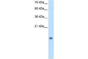 Cystatin B antibody used at 0.