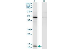Western Blot analysis of CCL2 expression in transfected 293T cell line by CCL2 monoclonal antibody (M05), clone 1F10.