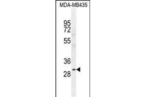 CLEC10A Antibody (N-term) (ABIN654515 and ABIN2844239) western blot analysis in MDA-M cell line lysates (35 μg/lane). (CLEC10A anticorps  (N-Term))