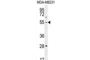 Western Blotting (WB) image for anti-Matrix Metallopeptidase 1 (Interstitial Collagenase) (MMP1) antibody (ABIN2996416) (MMP1 anticorps)