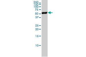 YES1 monoclonal antibody (M02), clone 3C6 Western Blot analysis of YES1 expression in Jurkat . (YES1 anticorps  (AA 1-80))