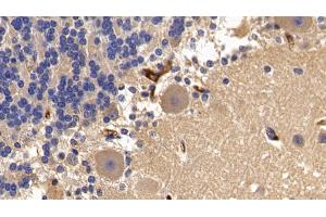 Detection of a2M in Porcine Cerebellum Tissue using Polyclonal Antibody to Alpha-2-Macroglobulin (a2M)