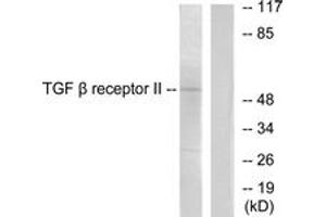 Western blot analysis of extracts from HepG2 (65K)  cells, using TGF beta Receptor II Antibody.