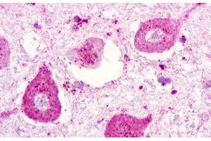 anti-Purinergic Receptor P2Y, G-Protein Coupled, 1 (P2RY1) (C-Term) antibody