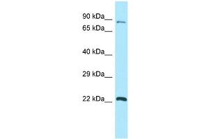 WB Suggested Anti-GPSM1 Antibody Titration: 1. (GPSM1 anticorps  (C-Term))