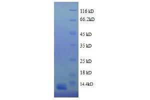 SDS-PAGE (SDS) image for Hemoglobin (full length) protein (ABIN1045101) (Hemoglobin Protein (full length))