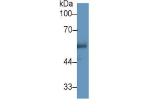 Rabbit Capture antibody from the kit in WB with Positive Control: Sample Human Urine.