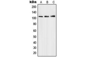 Western blot analysis of PMS1 expression in HepG2 (A), Molt4 (B), A549 (C) whole cell lysates. (PMS1 anticorps  (Center))
