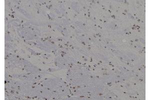 ABIN6265102 and ABIN6277278 at 1/100 staining Rat brain tissue by IHC-P.