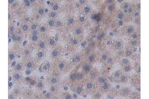 Detection of STAT2 in Rat Liver Tissue using Polyclonal Antibody to Signal Transducer And Activator Of Transcription 2 (STAT2)