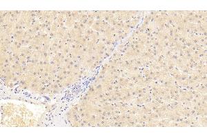 Detection of AT in Human Liver Tissue using Monoclonal Antibody to Antithrombin (AT)