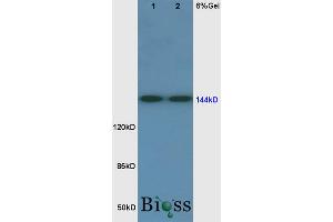 Rat lung lysates 30ug, probed (ABIN725795) at 1:200 overnight in 4 °C.