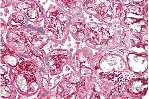 ABIN2613490 (2. (Tropomyosin 4 anticorps  (C-Term))