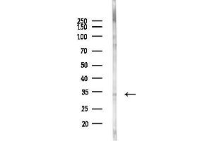 Western blot analysis of lysates from EC304 cells(heat-shock,45 min treatment), using GOLPH3 Antibody at 1/1000 dilution.