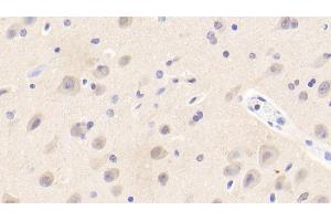 Detection of EFNA3 in Human Cerebrum Tissue using Polyclonal Antibody to Ephrin A3 (EFNA3) (Ephrin A3 anticorps  (AA 30-238))