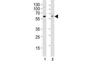 Western blot analysis of lysate from (1) HT29 and (2) Jurkat cell line using anti-Src antibody at 1:1000.