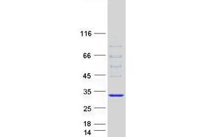 Validation with Western Blot