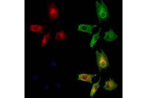 ABIN6260208 and ABIN6273200 staining HUVEC cells by IF/ICC.