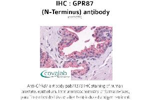 Image no. 1 for anti-G Protein-Coupled Receptor 87 (GPR87) (Extracellular Domain), (N-Term) antibody (ABIN1735187)