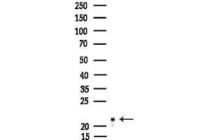 Western blot analysis of lysates from EC304 cells, using BORG3 Antibody at 1/1000 dilution.