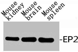 Western Blot analysis of RAT-KIDNEY MOUSE-BRAIN MOUSE-HEART using EP2 Polyclonal Antibody.