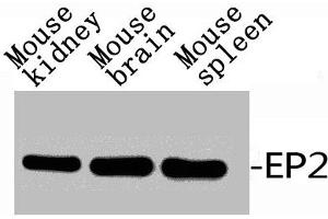 Western Blot analysis of RAT-KIDNEY MOUSE-BRAIN MOUSE-HEART using EP2 Polyclonal Antibody. (PTGER2 anticorps  (C-Term))
