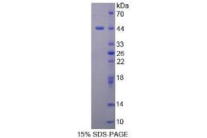 SDS-PAGE analysis of Mouse DHPS Protein. (DHPS Protéine)