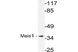 Western blot (WB) analysis of Meis1 antibody in extracts from Jurkat cells. (MEIS1 anticorps)