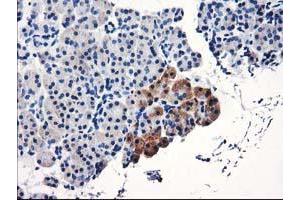 Immunohistochemical staining of paraffin-embedded Human pancreas tissue using anti-TBC1D21 mouse monoclonal antibody. (TBC1D21 anticorps)