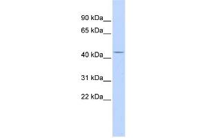 WB Suggested Anti-ACP2 Antibody Titration:  0. (ACP2 anticorps  (Middle Region))