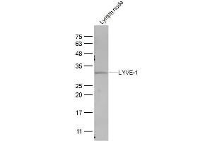 Mouse lymph Node lysates probed with LYVE-1 Polyclonal Antibody, Unconjugated  at 1:300 dilution and 4˚C overnight incubation. (LYVE1 anticorps  (AA 51-150))