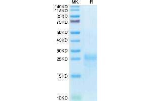 Cynomolgus CTLA-4 on Tris-Bis PAGE under reduced condition. (CTLA4 Protein (AA 37-160) (His tag))
