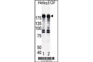 Western blot analysis of EGFR in Hela cell lysates, either induced (Lane 1) or noninduced with EGF (Lane 2). (EGF anticorps  (AA 1048-1077))