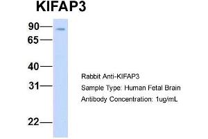 Host: Rabbit  Target Name: KIFAP3  Sample Tissue: Human Fetal Brain  Antibody Dilution: 1. (KIFAP3 anticorps  (Middle Region))