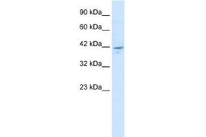 Human HepG2; WB Suggested Anti-ZNF237 Antibody Titration: 1. (ZMYM5 anticorps  (N-Term))