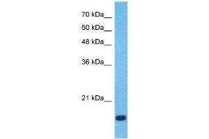 Host:  Rabbit  Target Name:  CCL18  Sample Type:  Fetal Lung lysates  Antibody Dilution:  0. (CCL18 anticorps  (Middle Region))