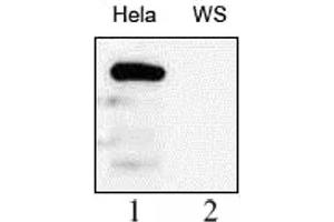 WRN antibody (mAb) tested by Western blot. (RECQL2 anticorps)