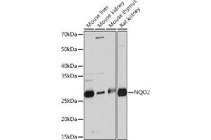 Western blot analysis of extracts of various cell lines, using NQO2 Rabbit mAb (ABIN7268962) at 1:1000 dilution.