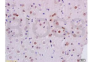 Formalin-fixed and paraffin embedded rat brain labeled with Anti DENTT Polyclonal Antibody, Unconjugated (ABIN722245) at 1:200 followed by conjugation to the secondary antibody and DAB staining (TSPY-Like 2 anticorps  (AA 251-350))